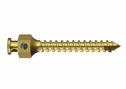 Chunli Medical's 'Orthodontic Mini-Implant' Approved for Market Release