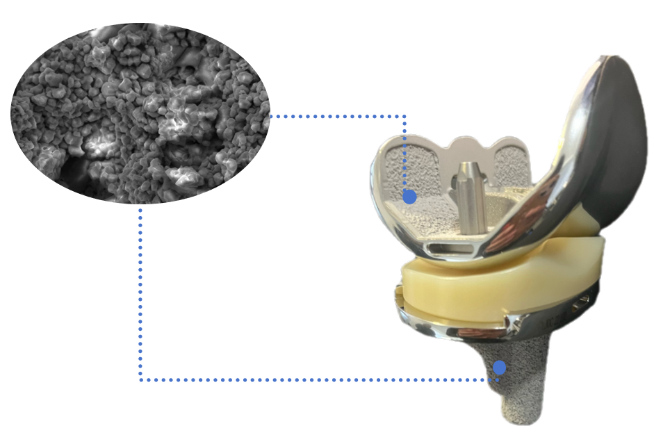 Chunli Medical's "Biological Total Knee Prosthesis" Approved for Marketing