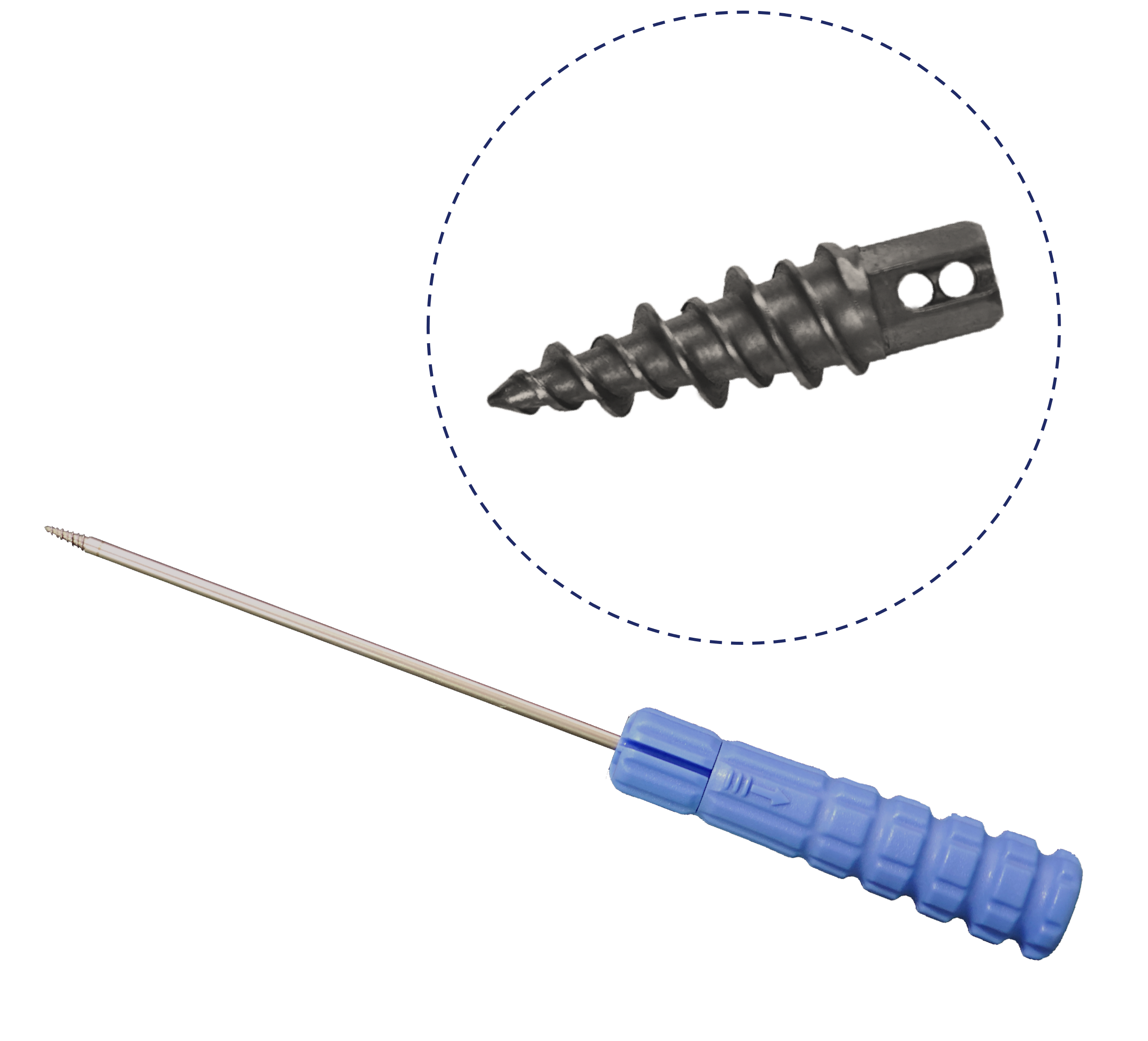 Tantalum Coated Suture Anchor