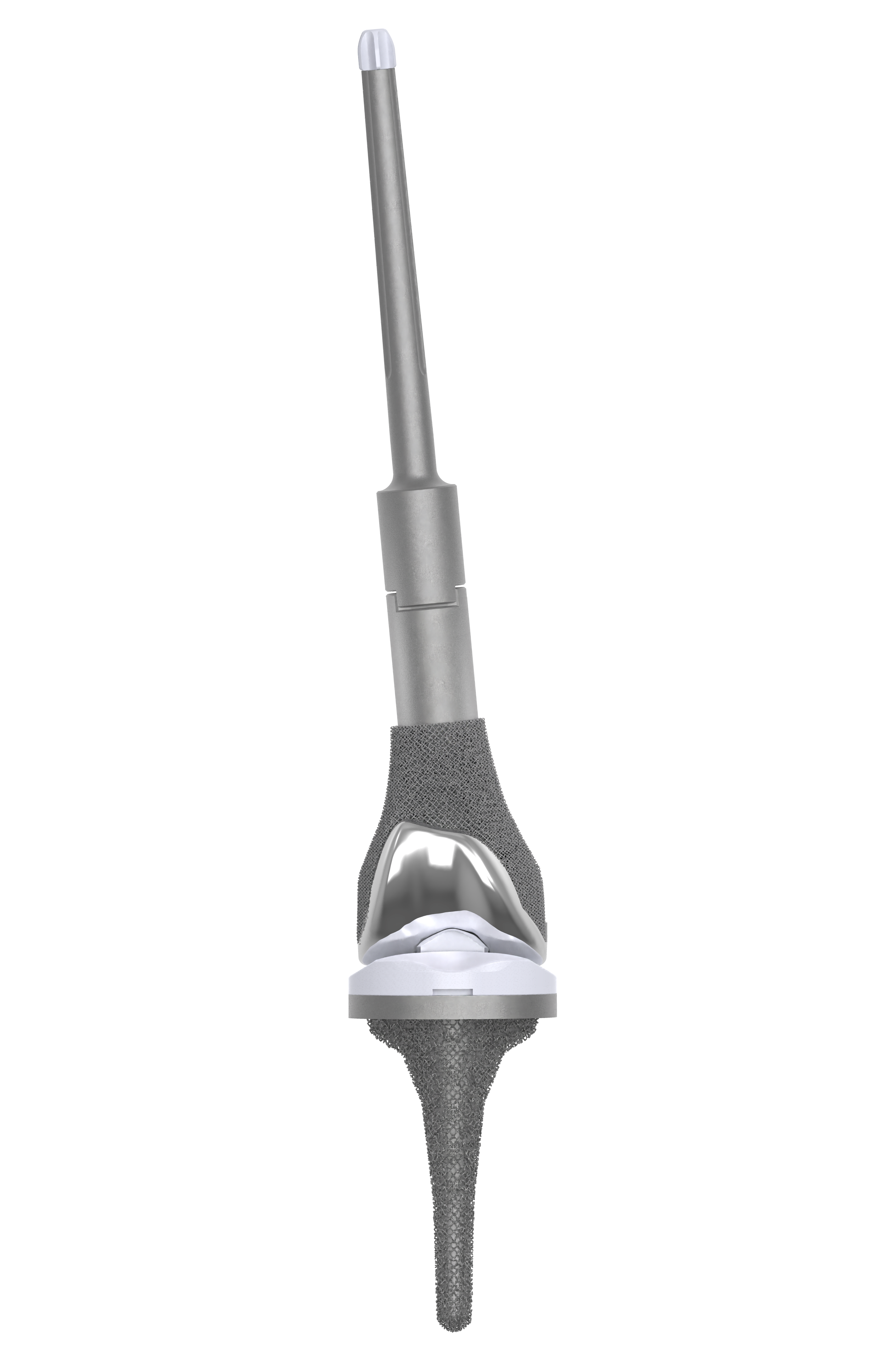 Modular knee prosthesis