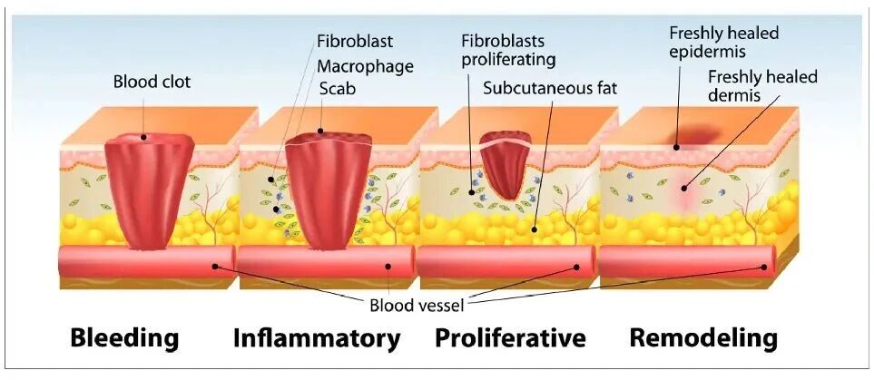 Platelet-Rich Plasma (PRP) Aids Skin Healing